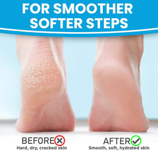 MADFORCOS Silky Coconut Oil Foot Mask 5 pairs/ 1 pair