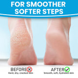 MADFORCOS Silky Coconut Oil Foot Mask 5 pairs/ 1 pair