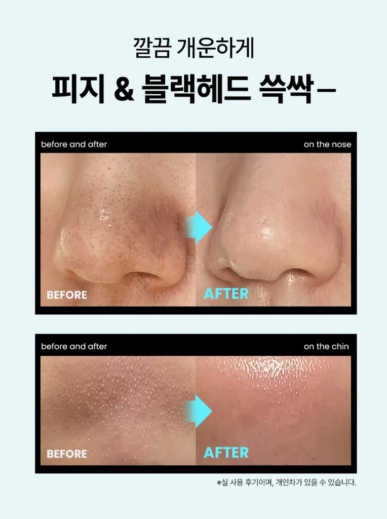 ILSO Super Melting Sebum Softenner 150ml+40cotton Pads