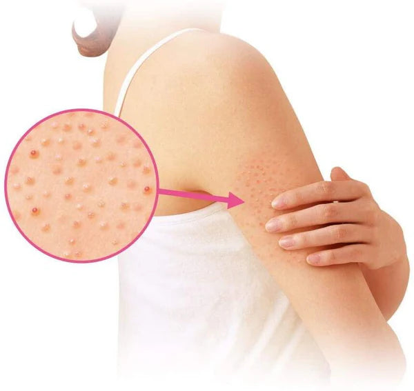 KOBAYASHI Nino Cure Medicated Cream 30g