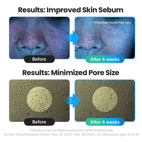 TORRIDEN Dive-In 低分子透明质酸精华 50ml