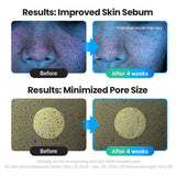 TORRIDEN Dive-In 低分子透明质酸精华 50ml