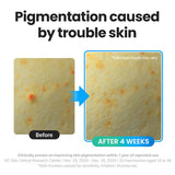 TORRIDEN Dive-In 低分子透明质酸精华 50ml