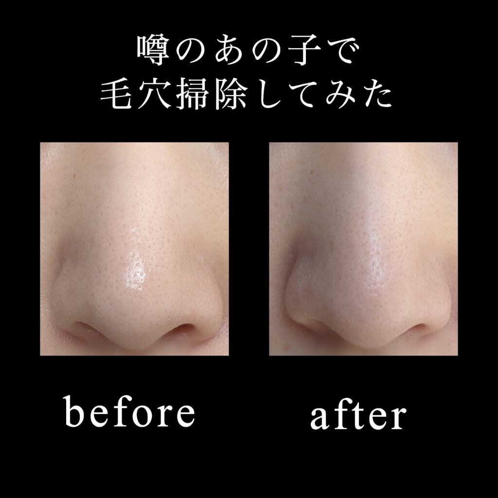 水桥保寿堂制药 去黑头乳液 200ml