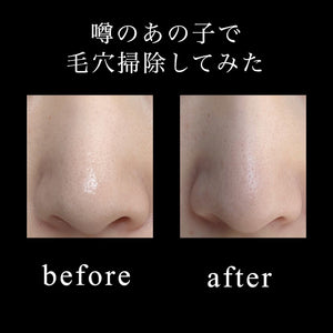 水桥保寿堂制药 去黑头乳液 200ml