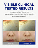 CKD Vita-C Teca Dark Spot Care Shot Mask (4+1sheets)